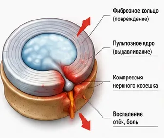 Запись на консультацию к врачу в Spinalux